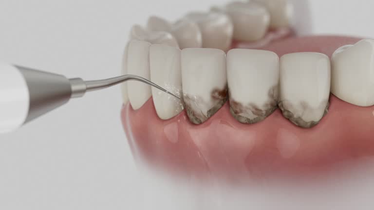 Reliable Dental Implants contractor in Felida, WA by Smile Center Dentistry